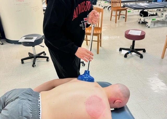 Student uses plunger for soft tissue mobilization during Manual Therapy Club